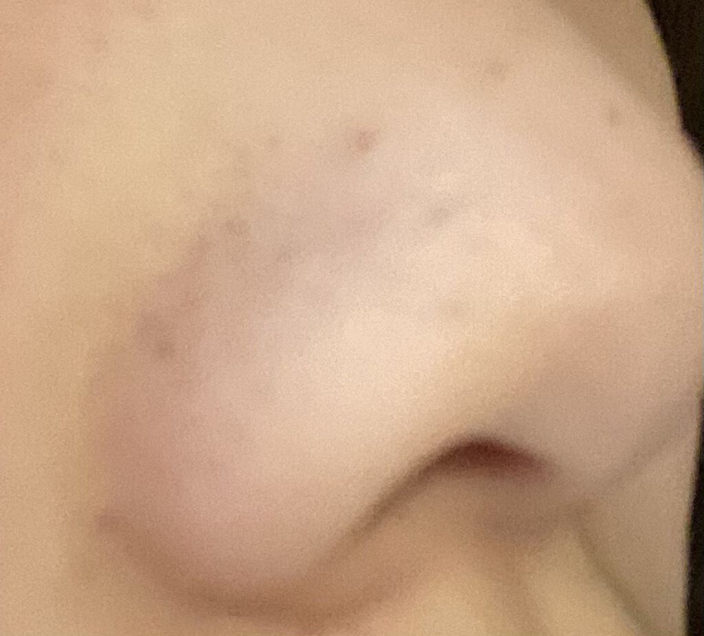 ハトムギ化粧水(ナチュリエ スキンコンディショナー R )/ナチュリエ/化粧水を使ったクチコミ（2枚目）