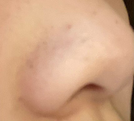 オリジナル ピュアスキンジェリー/ヴァセリン/ボディクリームを使ったクチコミ(2枚目)