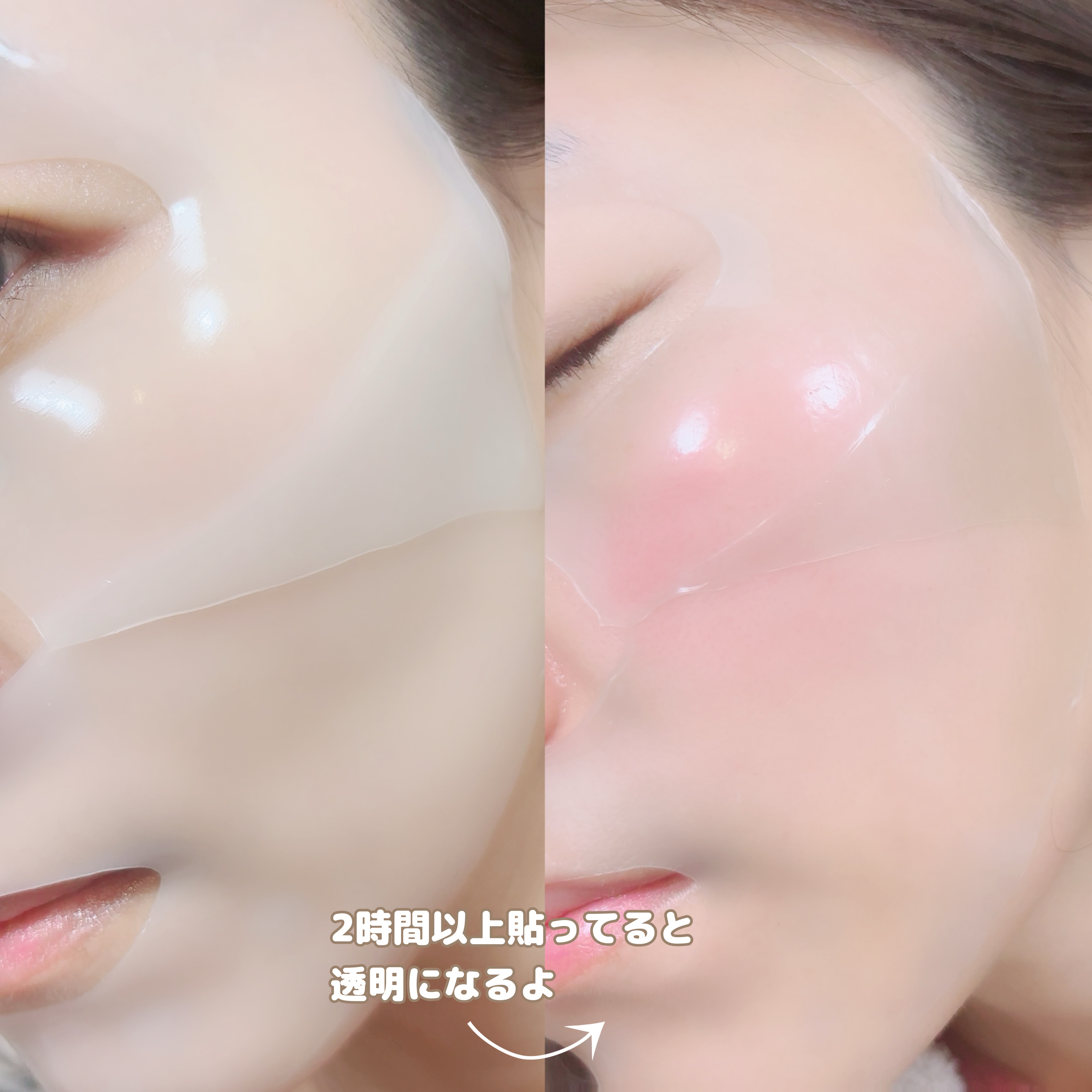 マイクロバイオームコラーゲンマスクパック/Sunnicorn/シートマスク・パックを使ったクチコミ（3枚目）