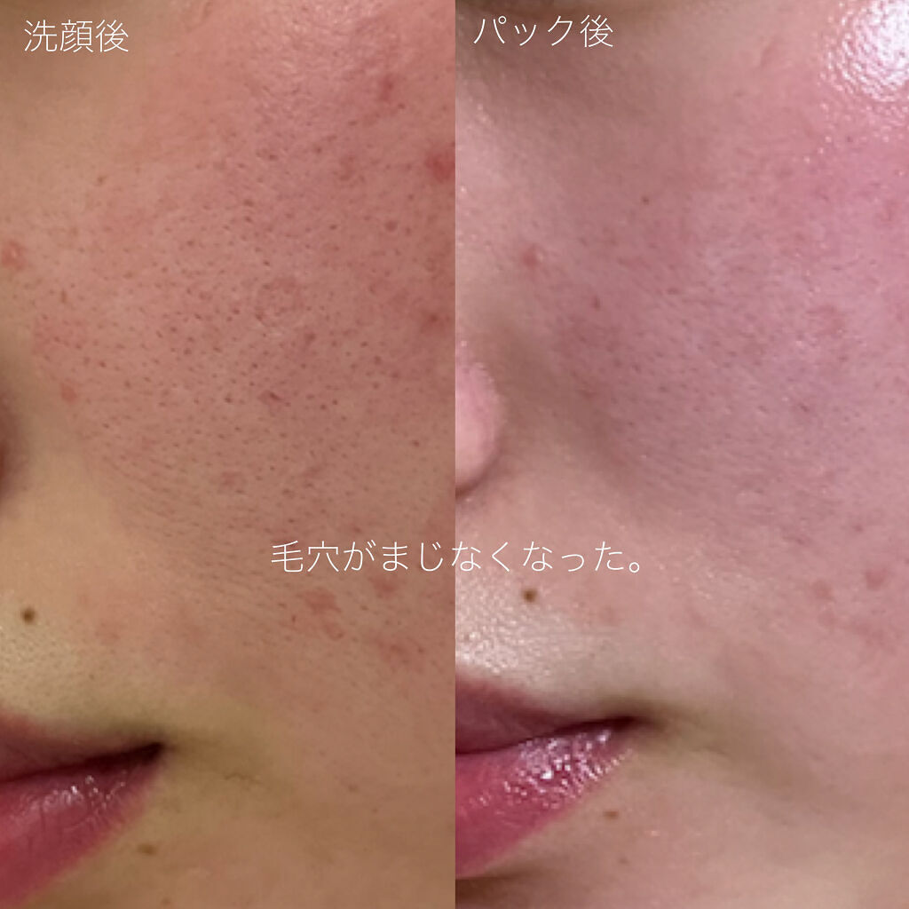 3番 耐えればすべすべキメケアシートマスク Numbuzinの使い方を徹底解説 毛穴に即効効く デート前必須パック Nu By 美肌を目指す女 フォロバ 混合肌 代前半 Lips