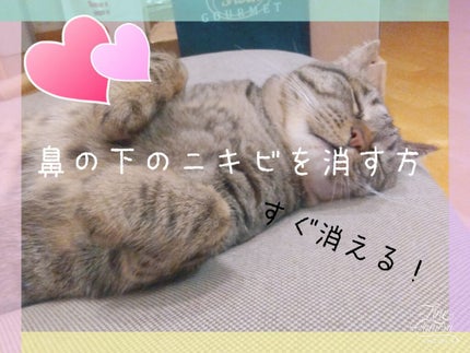 オロナインH軟膏 (医薬品)/オロナイン/その他を使ったクチコミ(1枚目)