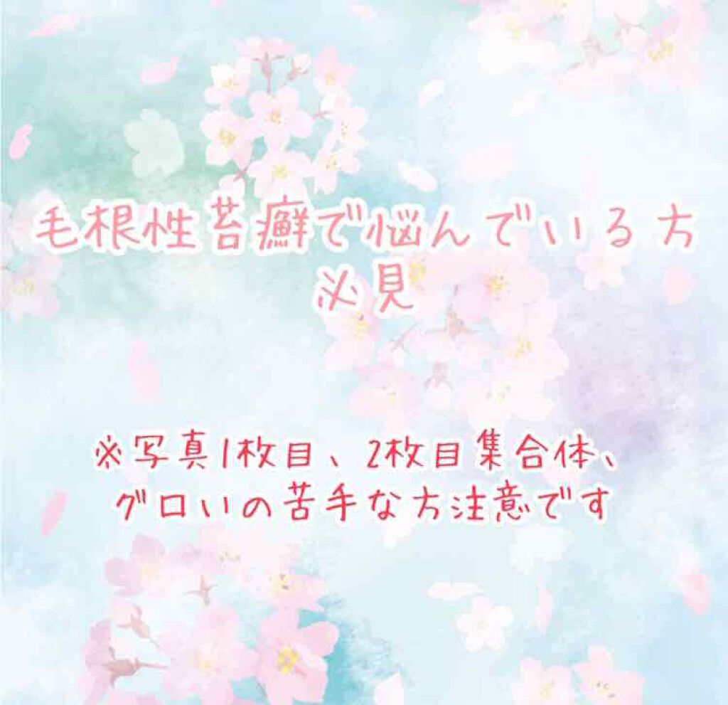 ハトムギ化粧水(ナチュリエ スキンコンディショナー R )/ナチュリエ/化粧水を使ったクチコミ(1枚目)