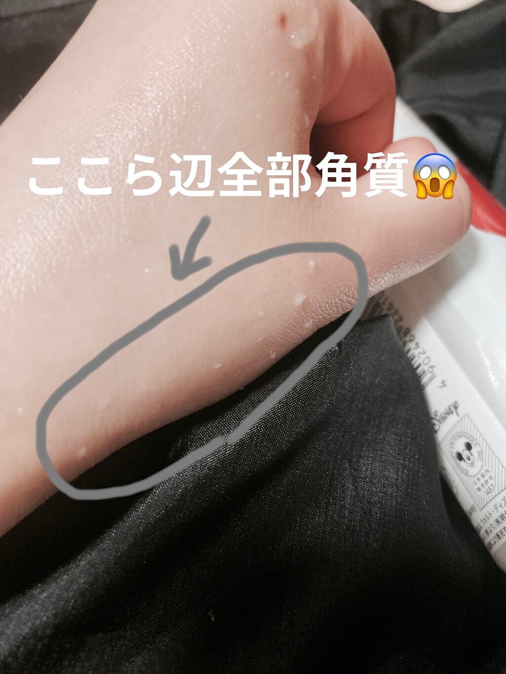 DETクリア ブライト&ピール ピーリングジェリー<無香料タイプ>/Detclear/ピーリングを使ったクチコミ(3枚目)