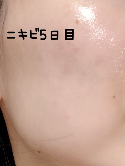 ハトムギ化粧水(ナチュリエ スキンコンディショナー R )/ナチュリエ/化粧水を使ったクチコミ(1枚目)