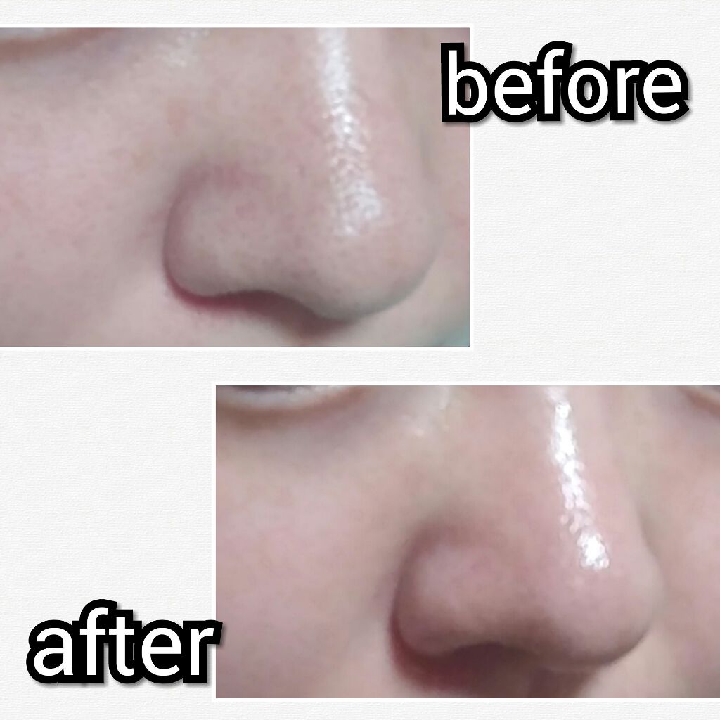 小鼻角質粘着糊/ポアナイス/シートマスク・パックを使ったクチコミ(3枚目)