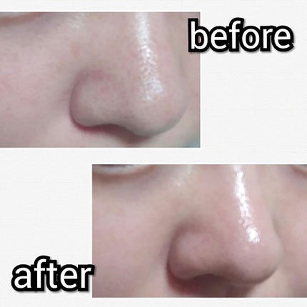 小鼻角質粘着糊/ポアナイス/シートマスク・パックを使ったクチコミ(3枚目)