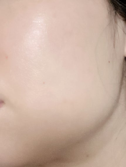 V コントア セラム/CLARINS/美容液を使ったクチコミ(1枚目)