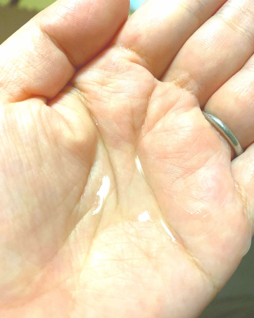 モイストバランス ローション/ACSEINE/化粧水を使ったクチコミ(2枚目)