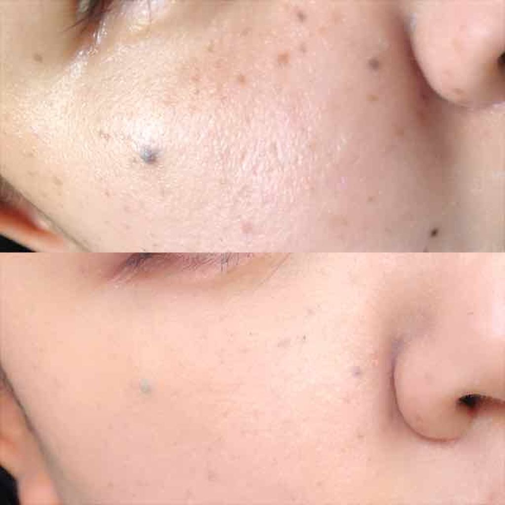 エアフィールメーカー/インテグレート/化粧下地を使ったクチコミ（2枚目）