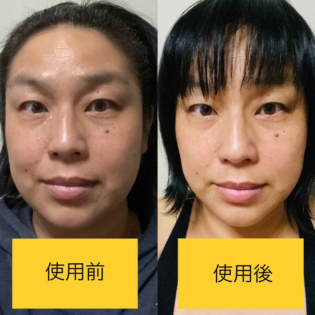 薬用美白・シワ改善オールインワンジェル/コラリッチ/オールインワン化粧品を使ったクチコミ(5枚目)