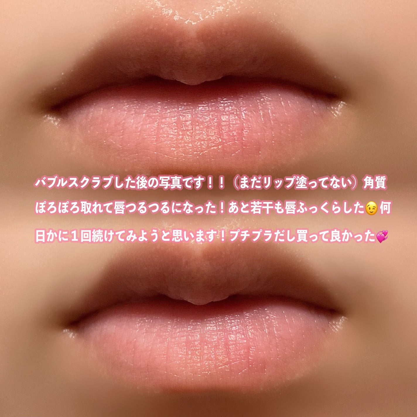 ブビブビ バブルリップスクラブ/unpa/リップスクラブを使ったクチコミ(3枚目)