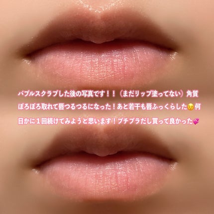 ブビブビ バブルリップスクラブ/unpa/リップスクラブを使ったクチコミ(3枚目)