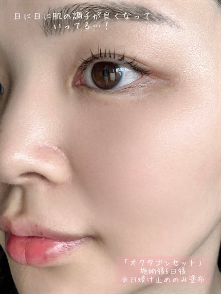 ãããð몚몚칎 on LIPS ãããããããµãŒãã¹ð¯ðð»ã©ã°ãžã¥ã¢ãªãŒãªããããçŸå®¹ã¯ãªããã¯..ãïŒ9æç®ïŒ