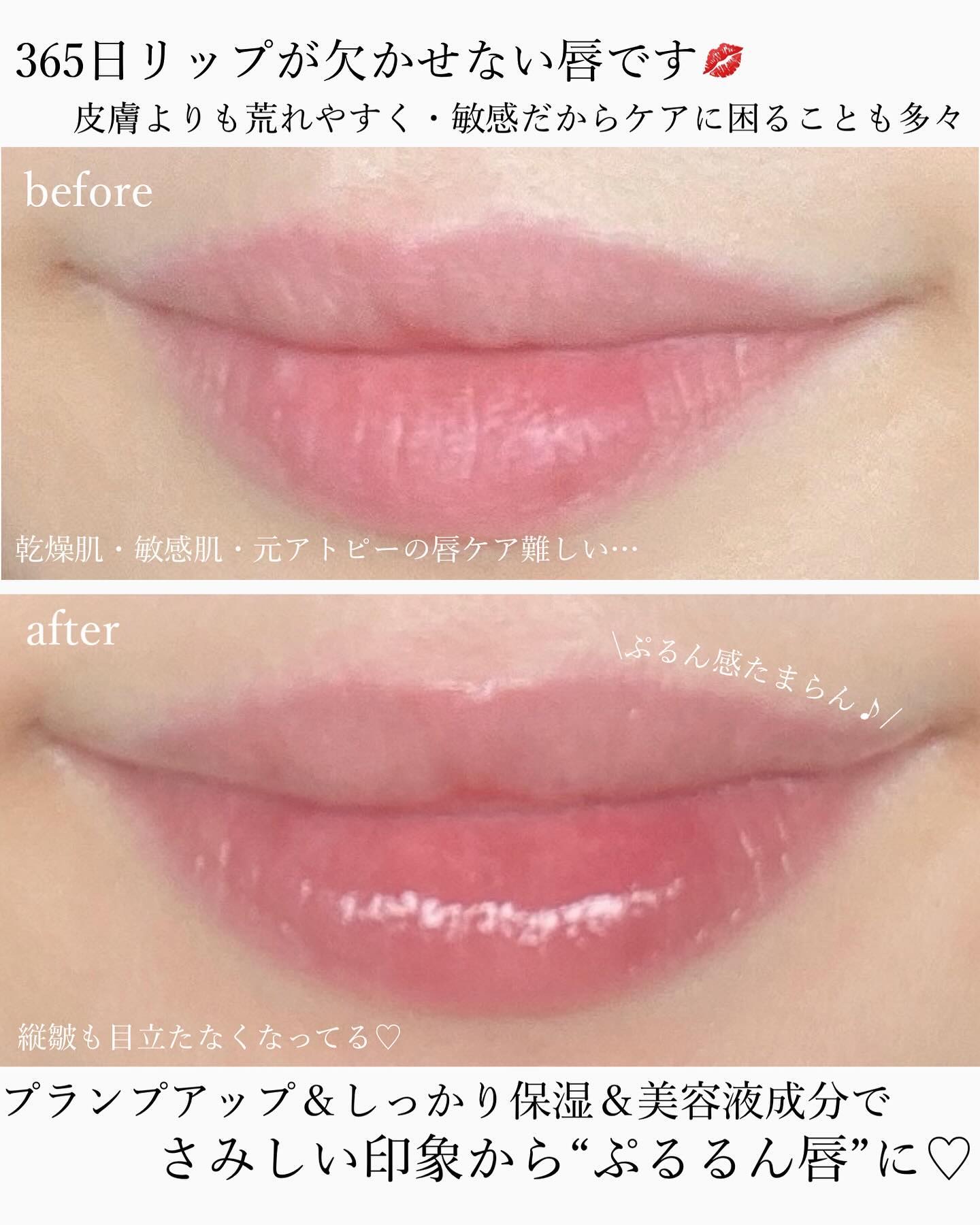 エスト ザ リップセラム/est/リップ美容液を使ったクチコミ（3枚目）