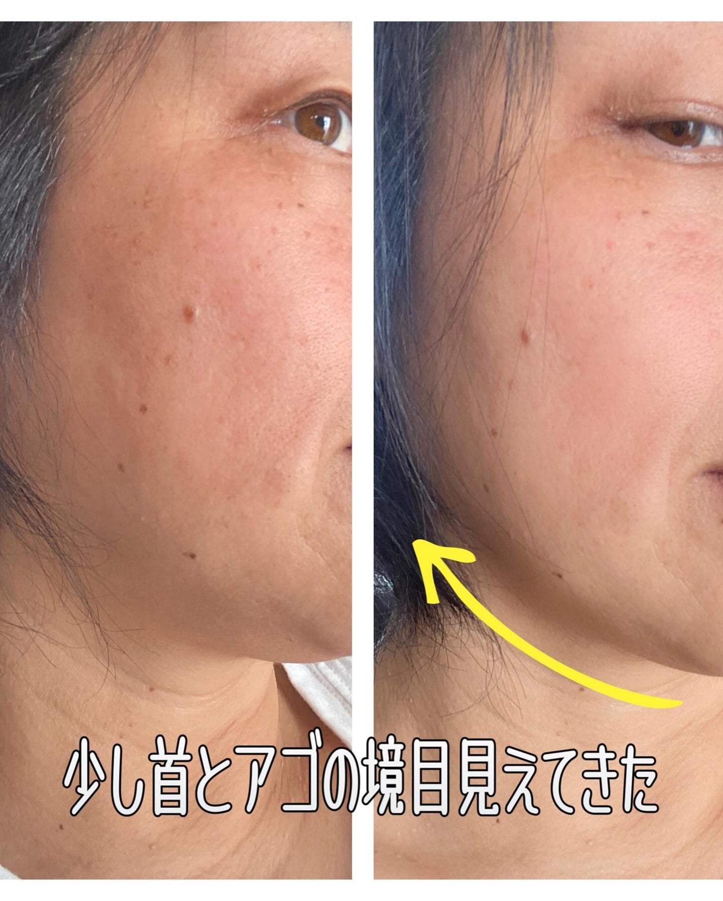 エンジェルメッサリフト/イッティ/その他を使ったクチコミ(7枚目)