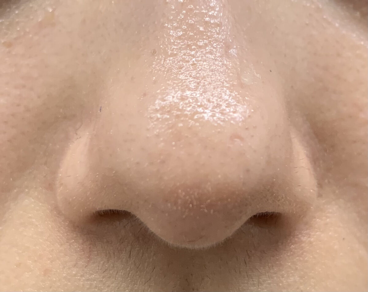 リンクルブライトセラム/オルビス/美容液を使ったクチコミ（3枚目）