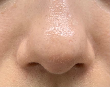 オルビスユー エッセンスローション /オルビス/化粧水を使ったクチコミ(3枚目)