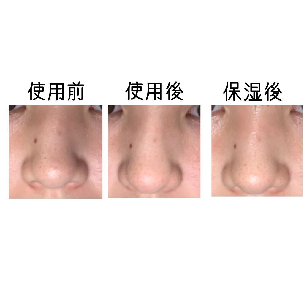 ハトムギ浸透乳液(ナチュリエ スキンコンディショニングミルク)/ナチュリエ/乳液を使ったクチコミ（2枚目）