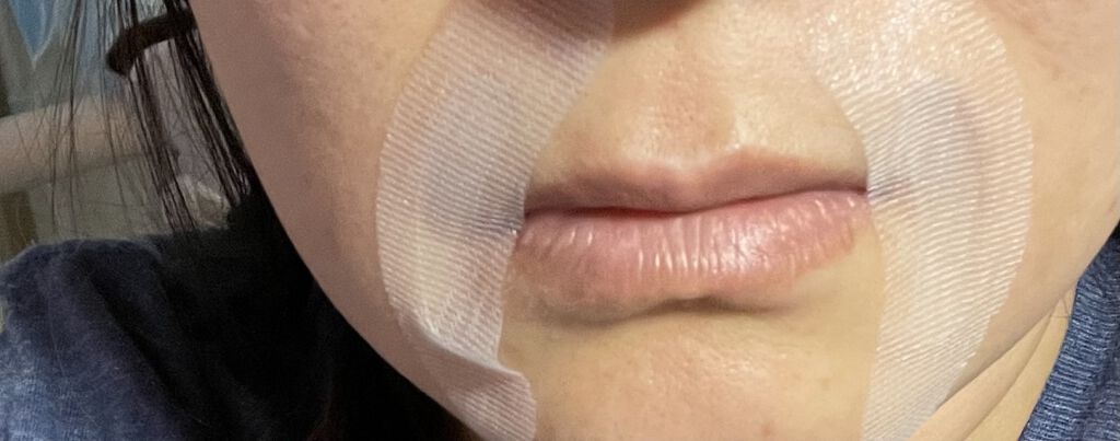 ヒアロディープパッチ/北の快適工房/シートマスク・パックを使ったクチコミ（1枚目）