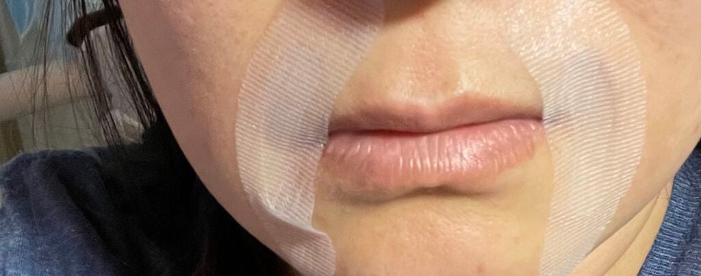 ヒアロディープパッチ/北の快適工房/シートマスク・パックを使ったクチコミ(1枚目)