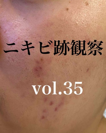 敏感肌用薬用美白美容液/無印良品/美容液を使ったクチコミ（1枚目）