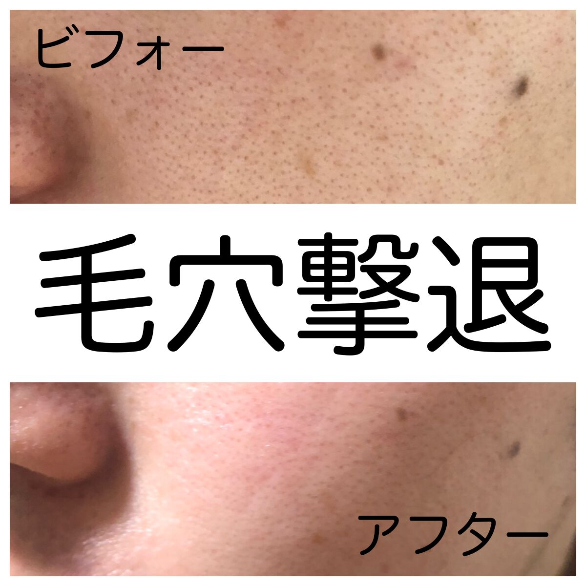 リポソーム アドバンスト リペアセラム/DECORTÉ/美容液を使ったクチコミ(1枚目)