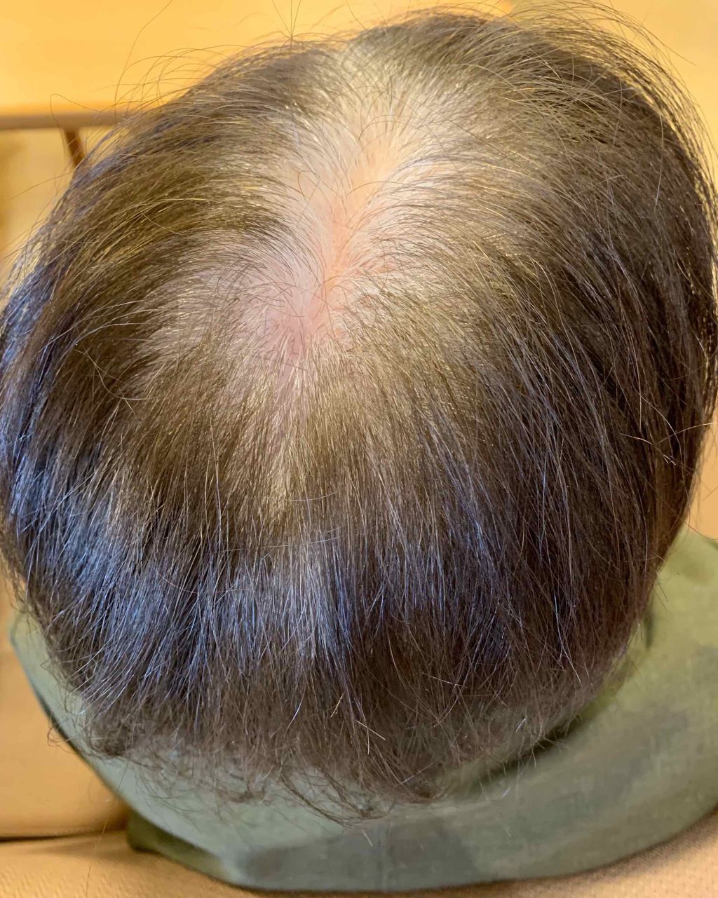 ウエラトーン リタッチコンシーラー/ウエラ/ヘアカラーを使ったクチコミ（3枚目）