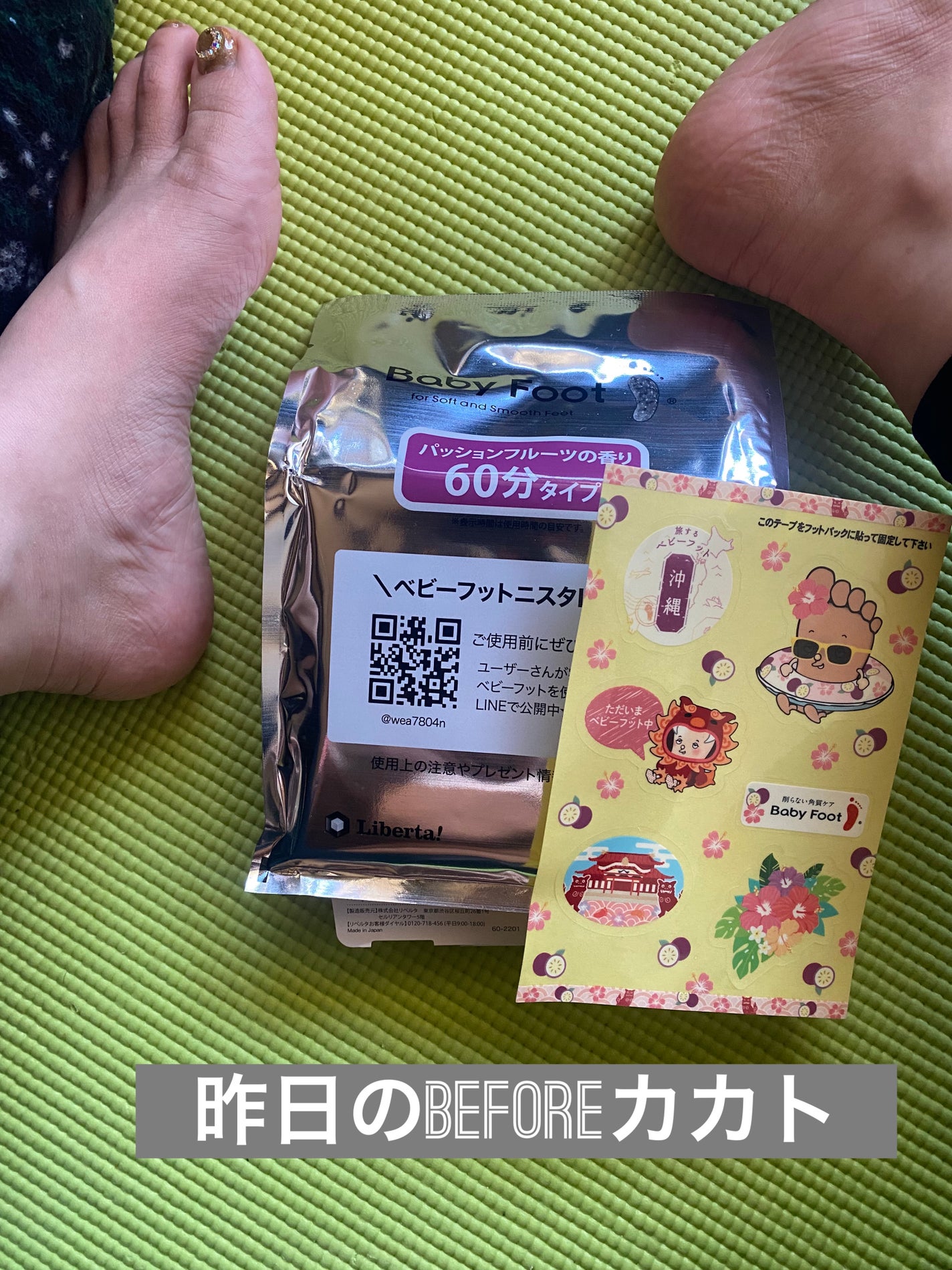 イージーパックSPT 30分タイプ/ベビーフット/レッグ・フットケアを使ったクチコミ(5枚目)
