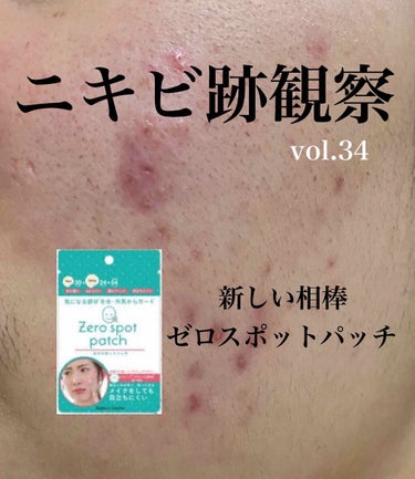 敏感肌用薬用美白美容液/無印良品/美容液を使ったクチコミ（1枚目）