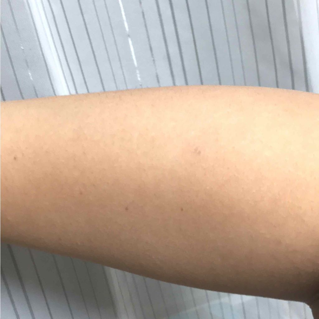 ホワイトCクリア(医薬品)/トランシーノ/その他を使ったクチコミ(2枚目)