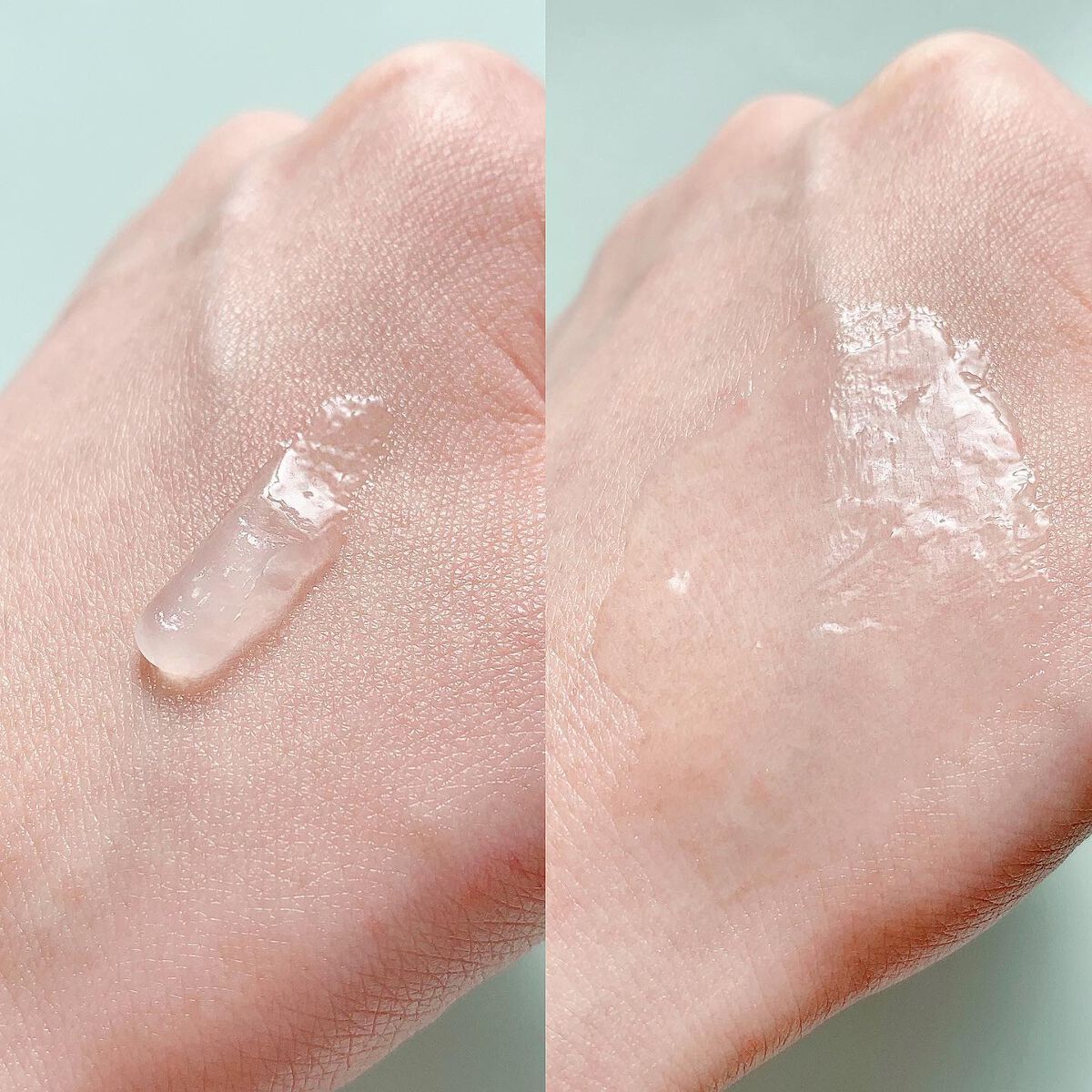 ピュアベール(医薬品)/プロペト/その他を使ったクチコミ（2枚目）