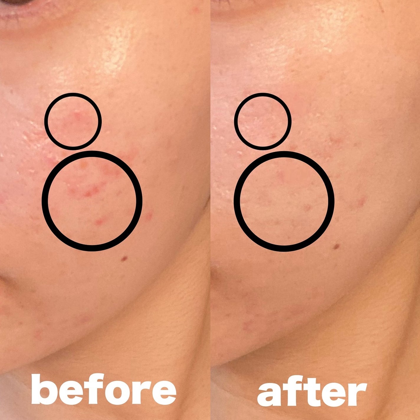 カバーアッププロコンシーラー/TFIT/パレットコンシーラーを使ったクチコミ(3枚目)