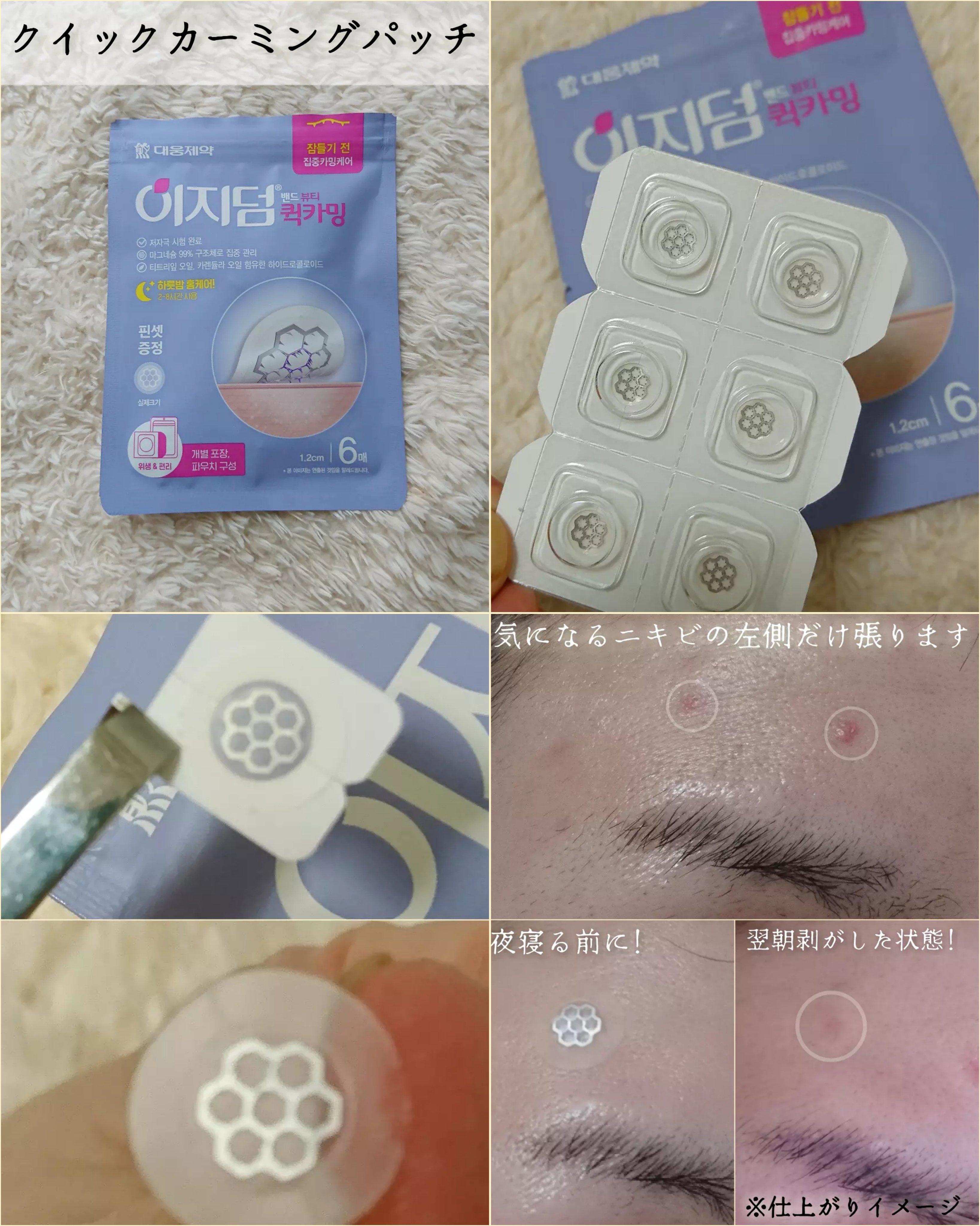 リアルカーミング/イージーダムビューティー/にきびパッチを使ったクチコミ（2枚目）