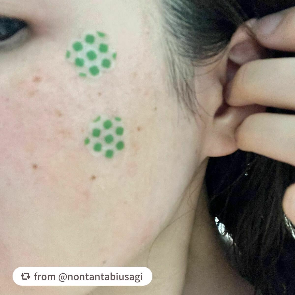 レチノール シカ フォーカシングパッチ/innisfree/にきびパッチを使ったクチコミ(2枚目)