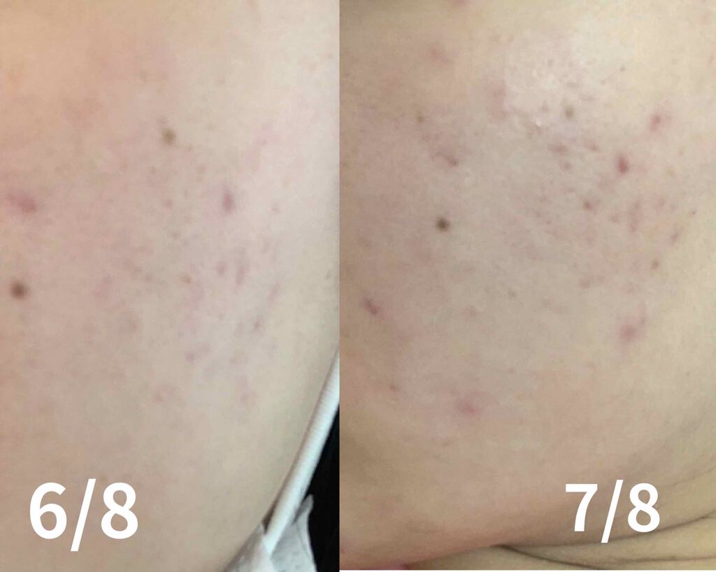 を使ったクチコミ（2枚目）