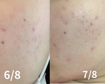 を使ったクチコミ(2枚目)