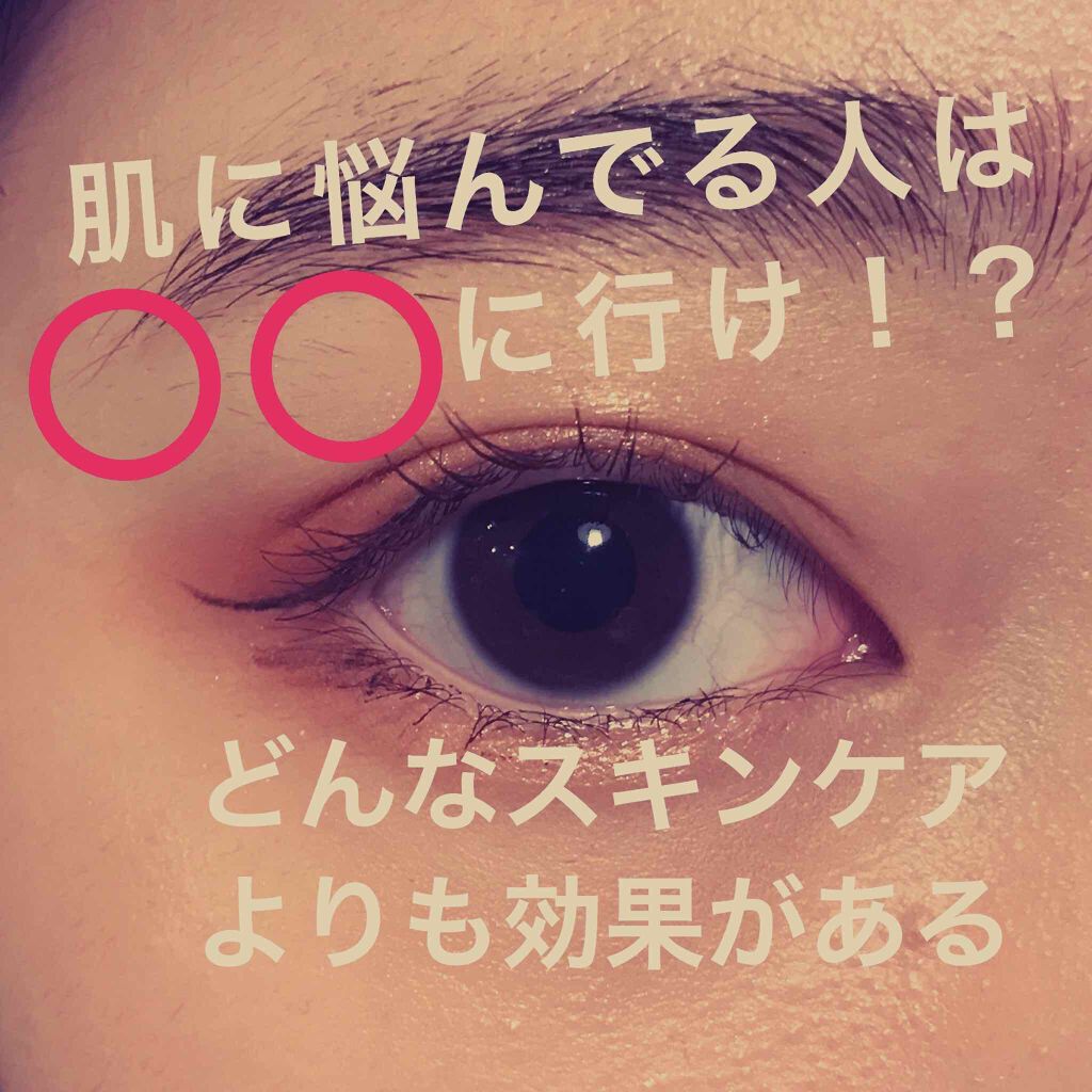 Qoo10愛用者 on LIPS 「凄いニキビに悩んでる方必見です。(本文は💪🦵💪から)お久しぶり..」(1枚目)