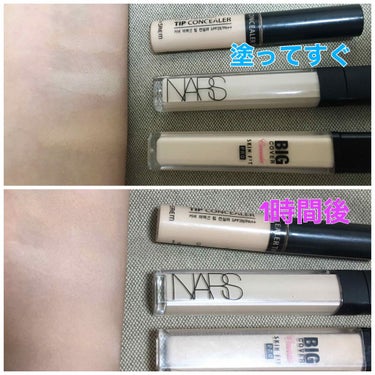 ラディアントクリーミーコンシーラー/NARS/リキッドコンシーラーを使ったクチコミ（1枚目）