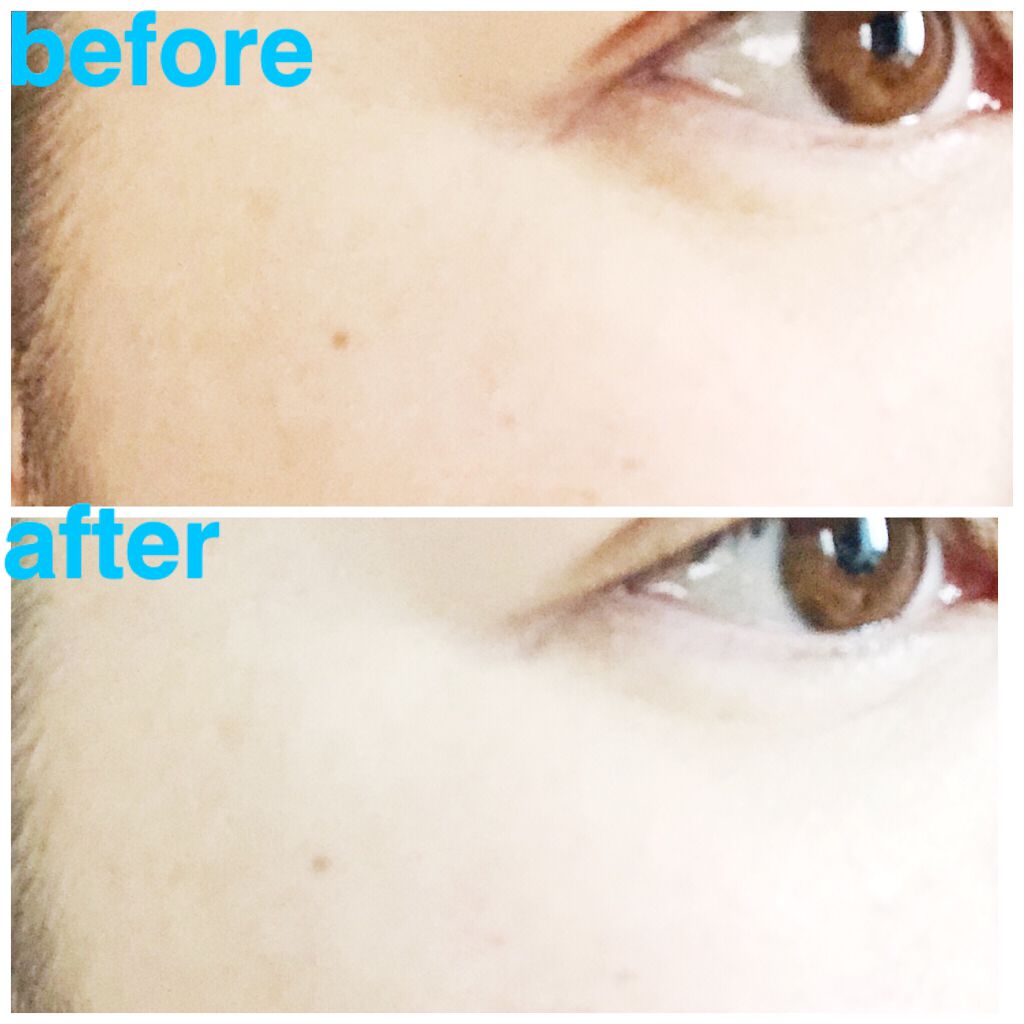 スキンリフレクト ラスティング UV クッションファンデーション/ADDICTION/クッションファンデーションを使ったクチコミ(10枚目)