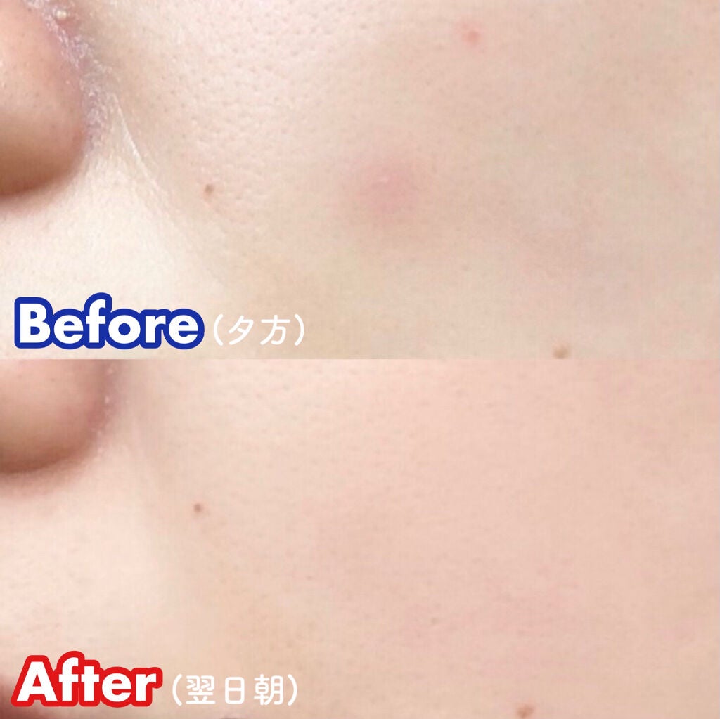 ダーマエクトシカデイリーマスク/Neulii/シートマスク・パックを使ったクチコミ(6枚目)