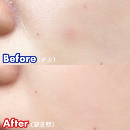 ダーマエクトシカデイリーマスク/Neulii/シートマスク・パックを使ったクチコミ(6枚目)