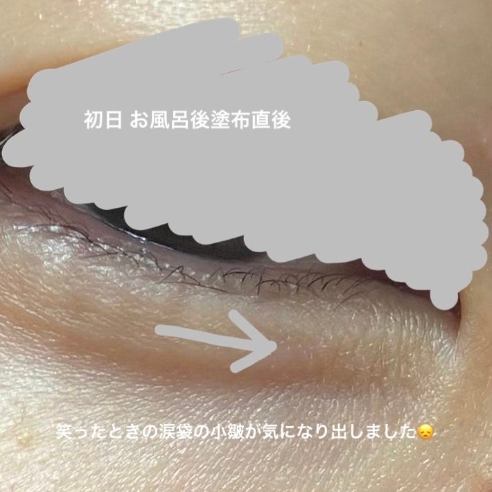 ザ セラム リンクルリペア 夜用 /アスタリフト/美容液を使ったクチコミ(2枚目)