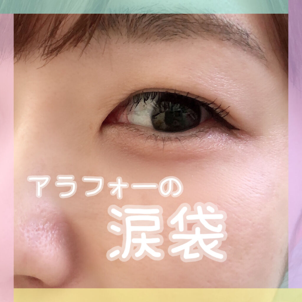 サイレントカバー コンシーラー/excel/パレットコンシーラーを使ったクチコミ（1枚目）