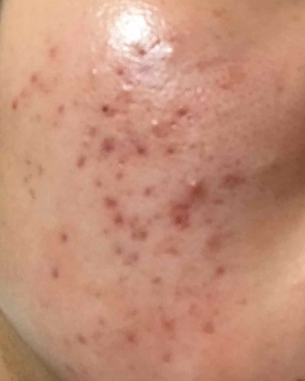 VC100エッセンスローション/ドクターシーラボⓇ/化粧水を使ったクチコミ(2枚目)