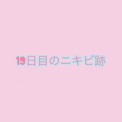 DHC マルチビタミン/DHC/美容サプリメントを使ったクチコミ(1枚目)