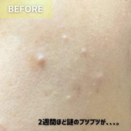 プロポリスレスキューアンプル 50ml/CNP Laboratory/美容液を使ったクチコミ(6枚目)