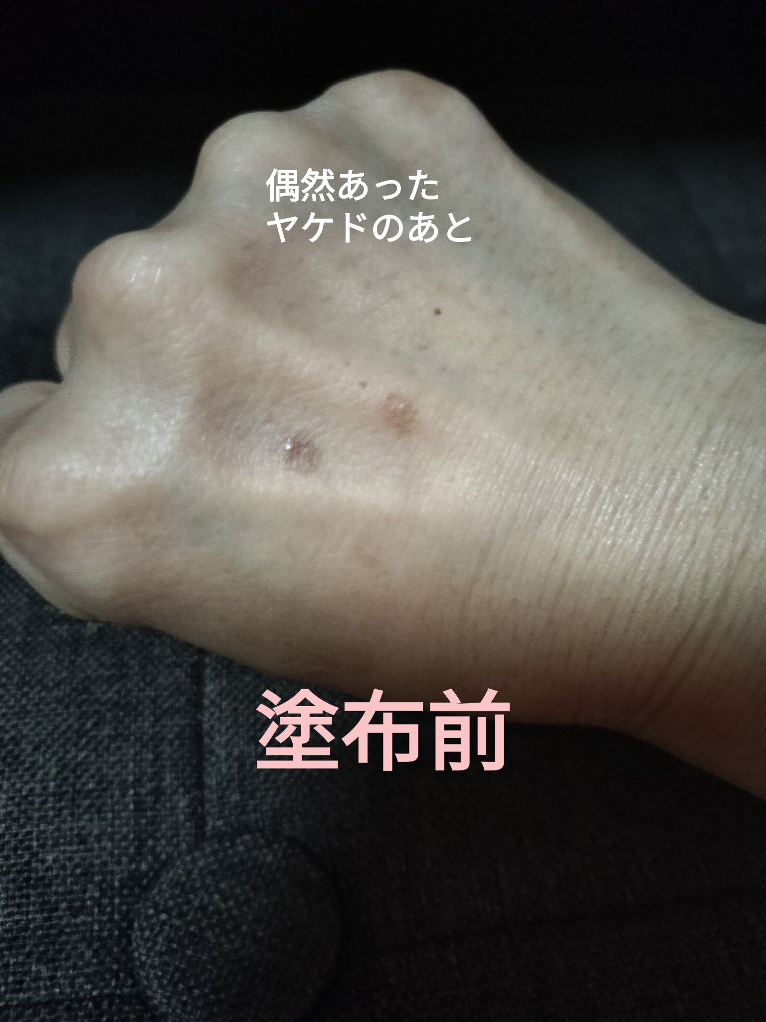 ピンクティーツリーカバープライマークッション/APLIN/クッションファンデーションを使ったクチコミ（2枚目）