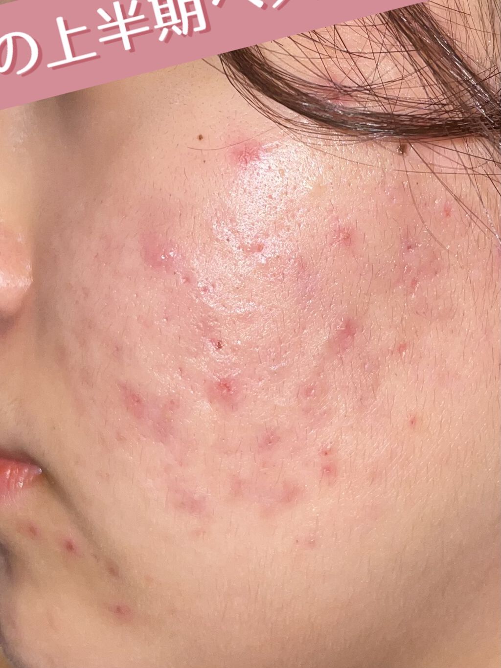 CICA カプセルマスク/VT/洗い流すパック・マスクを使ったクチコミ（3枚目）