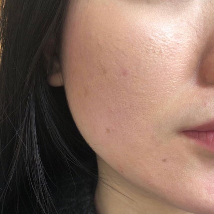 マジックコンシーラー サーモンベージュ/カリプソ/リキッドコンシーラーを使ったクチコミ(3枚目)