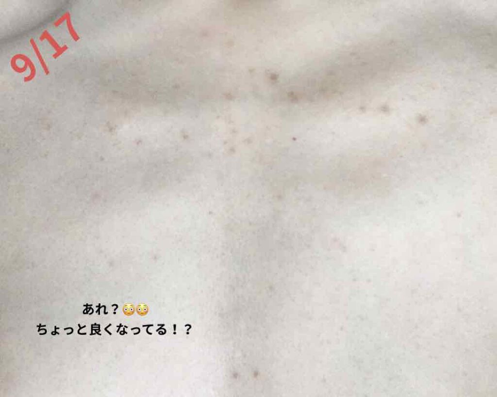 DHC マルチビタミン/DHC/美容サプリメントを使ったクチコミ(3枚目)